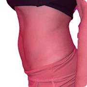 After treatment image of Amber J.