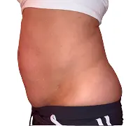 Before treatment image of Amber J.