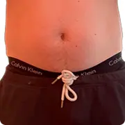 Before treatment image of Chuck C.